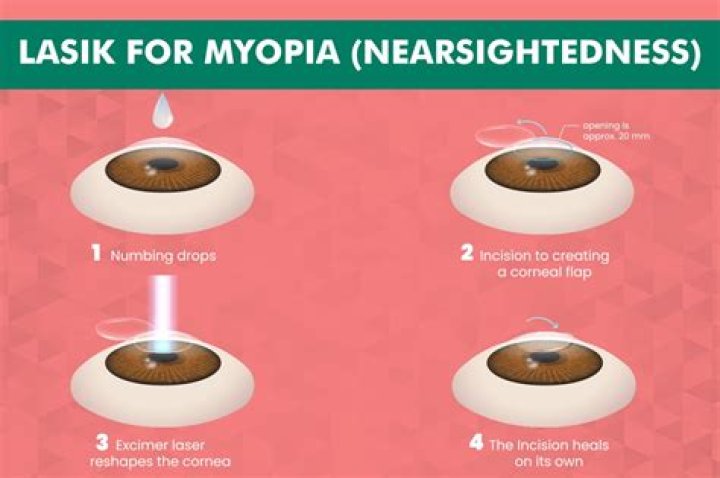 Can amblyopia be corrected with lasik?