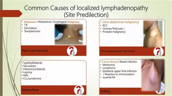 Can breastfeeding cause axillary lymphadenopathy?