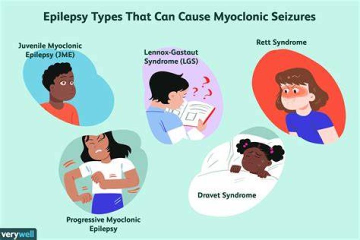 Can epileptic seizures kill you?