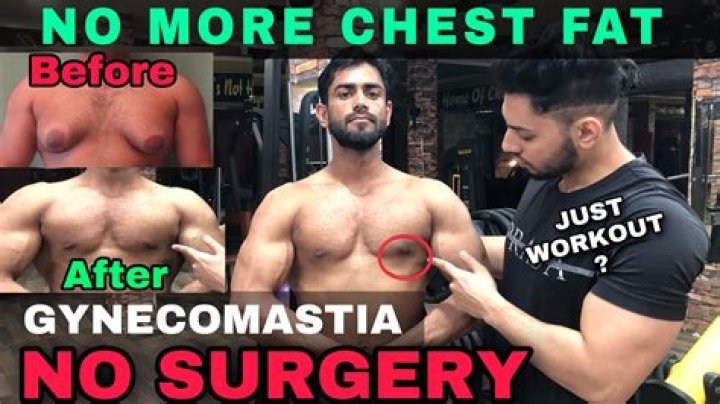 Can exercise get rid of gynaecomastia?