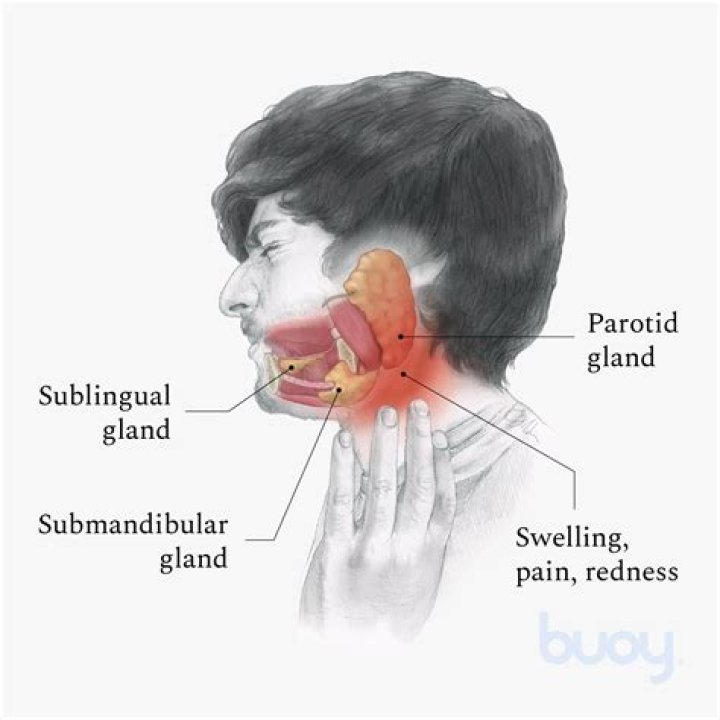 Can feel lump under jaw?