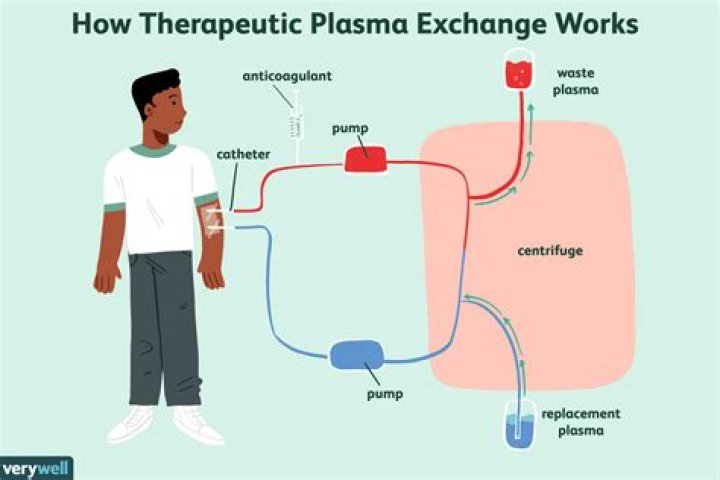 Can plasmapheresis cause bleeding?