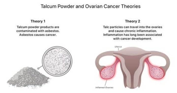 Can talcum powder cause cervical cancer?