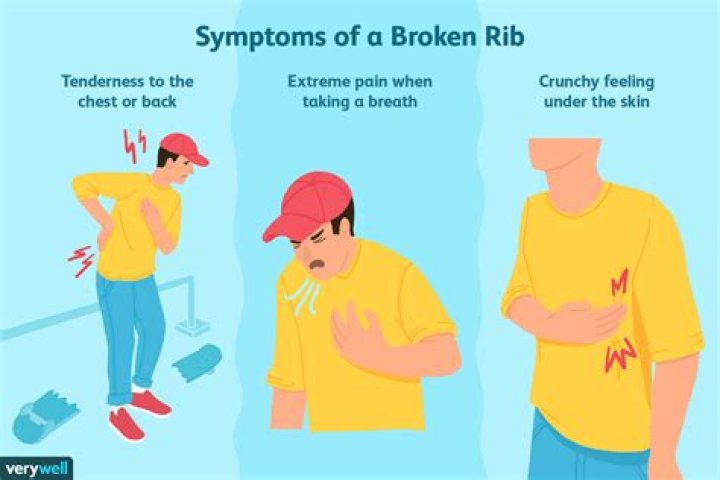 Can you crack a rib from coughing?