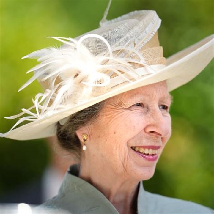 Did queen anne have lupus?