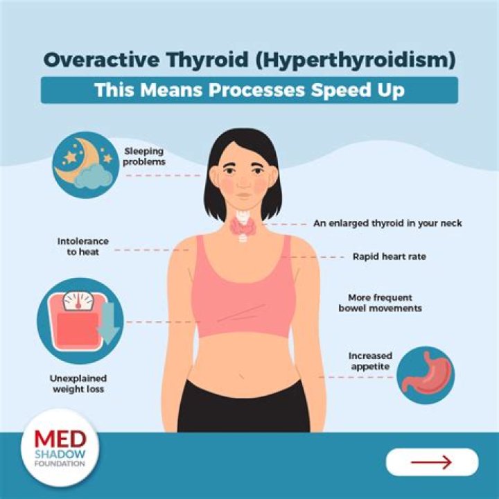 Does exercise make hyperthyroidism worse?