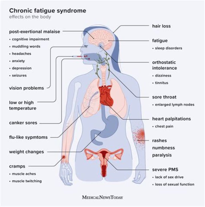 Does fatigue affect immune system?
