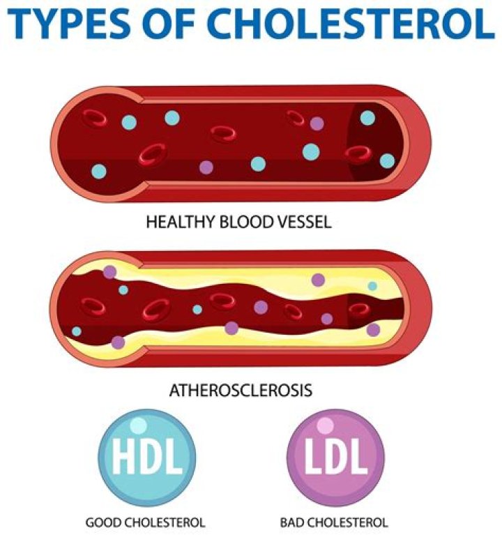 Does ldl cholesterol fluctuate?