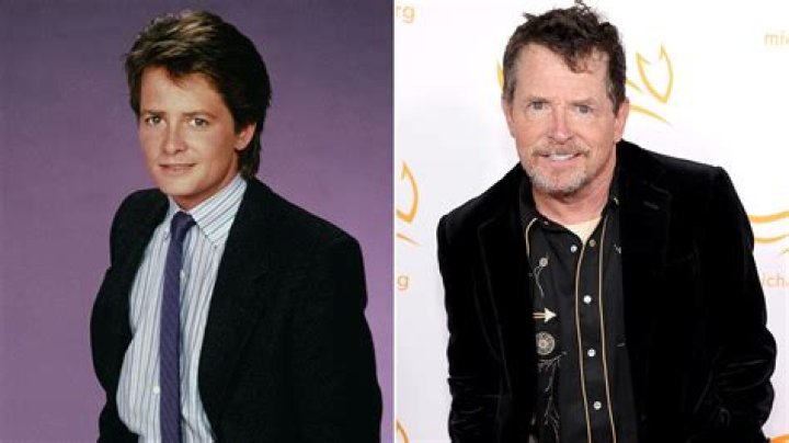 Does michael j fox have parkinson's?