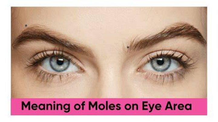 Does moles have eyes?