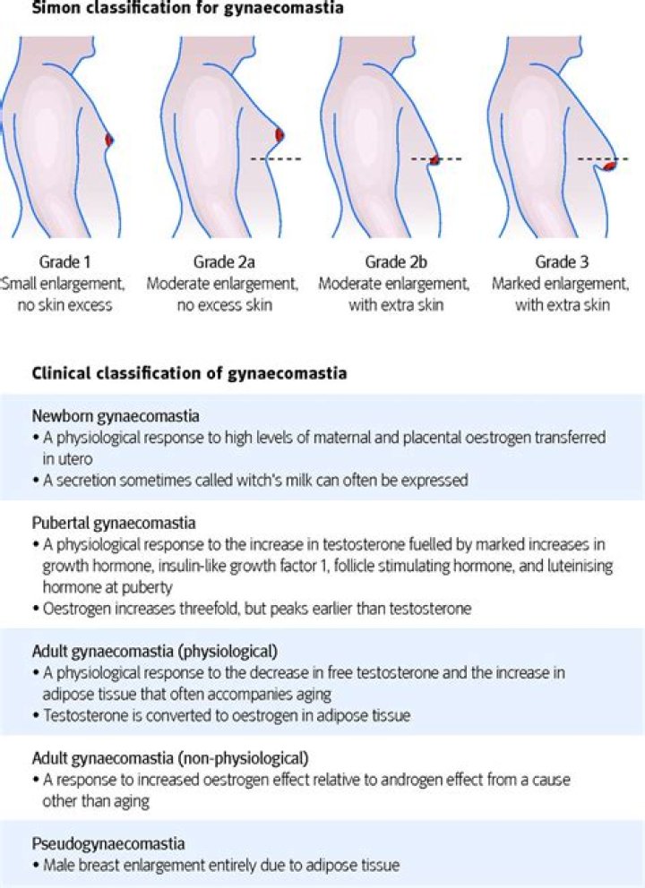 Does prolactin cause gynaecomastia?