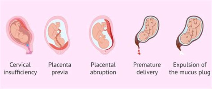 During pregnancy internal bleeding?