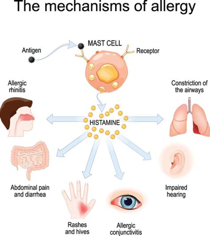 How do allergies work?