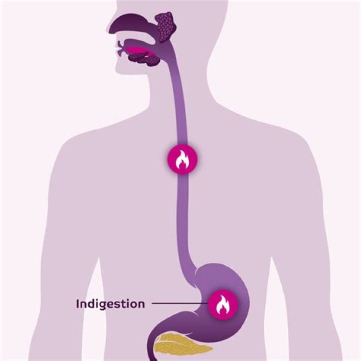 How do you cure indigestion?