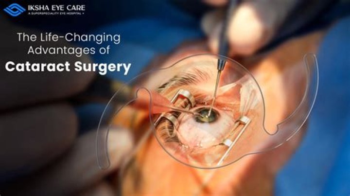 How is the eye numbed for cataract surgery?