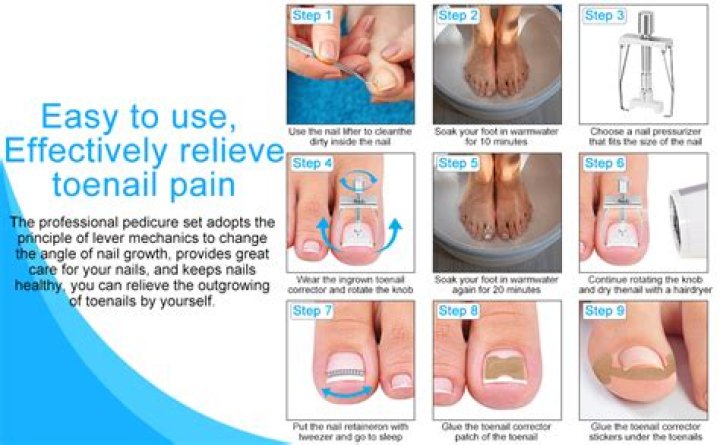 How to painlessly remove a toenail?