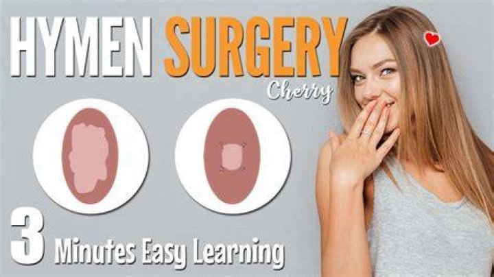 Is hymenectomy the same as hymenotomy?