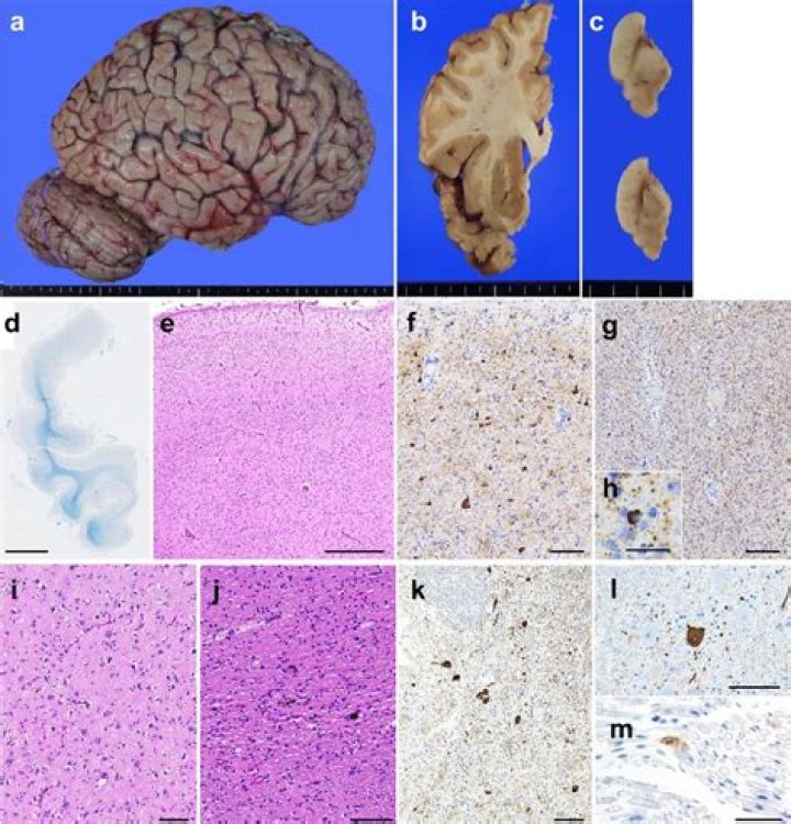 Is neuropathological a word?
