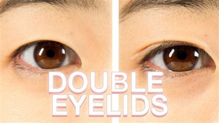 Was sind double eyelids?