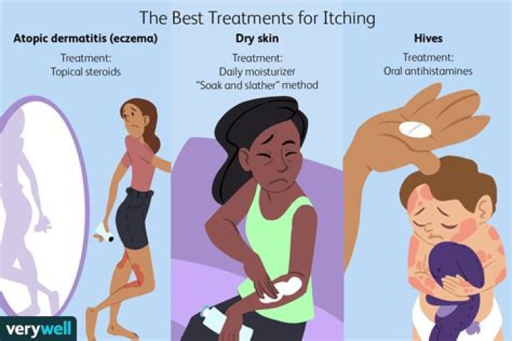 What causes itchiness after bathing?