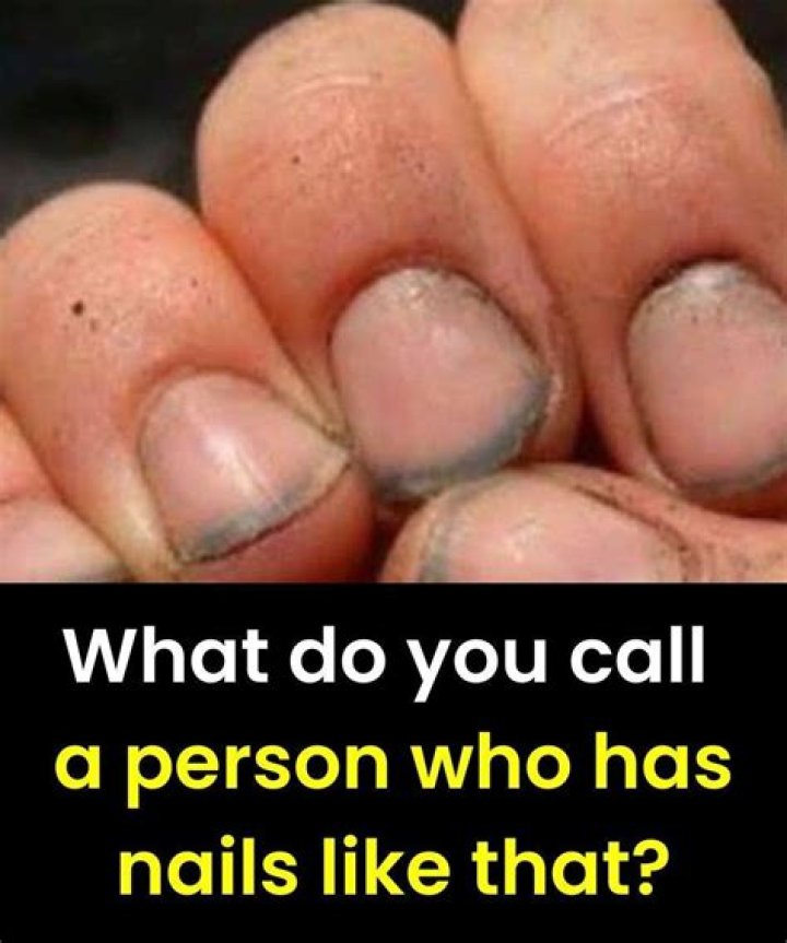 What do you call a person who is both handed?