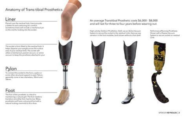 What does prosthesis mean?