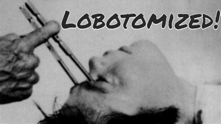 What does the word lobotomizing mean?