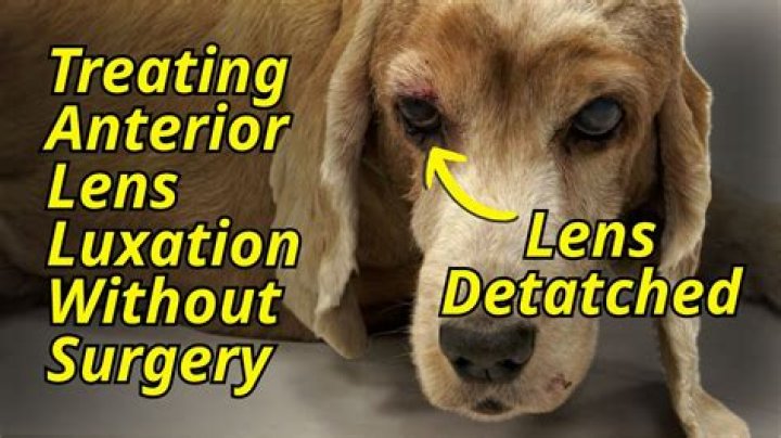 What is a lens luxations?