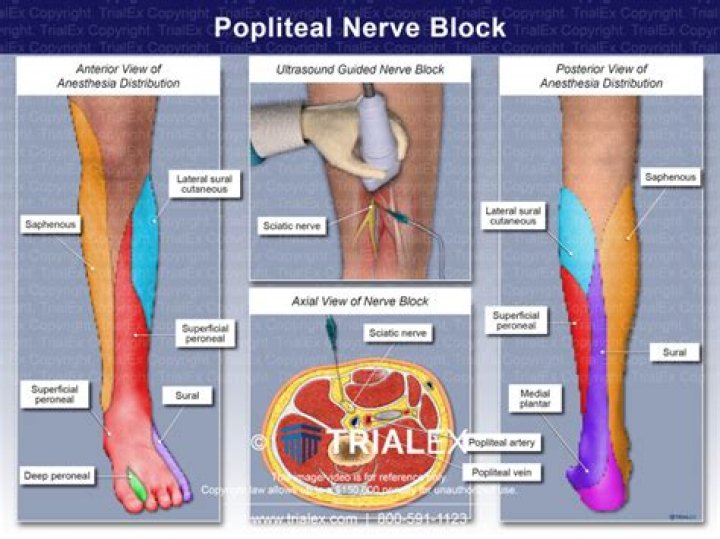 What is a popliteal block?