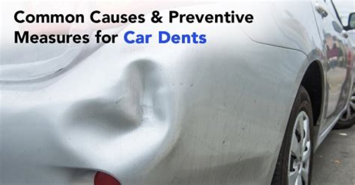 What is car dents?