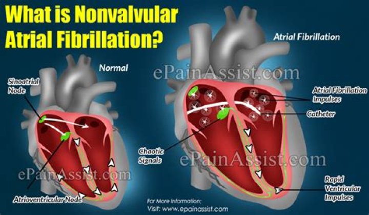 What is non valvular atrial fibrillation?
