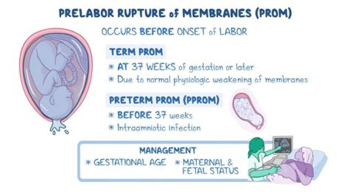 What is prolonged rupture of membranes?