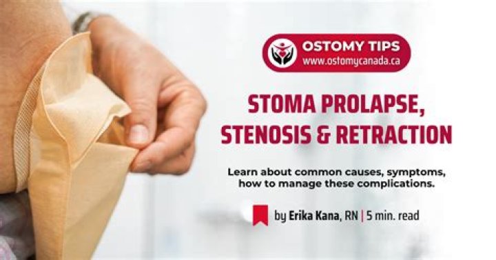 What is the meaning of stenosed?