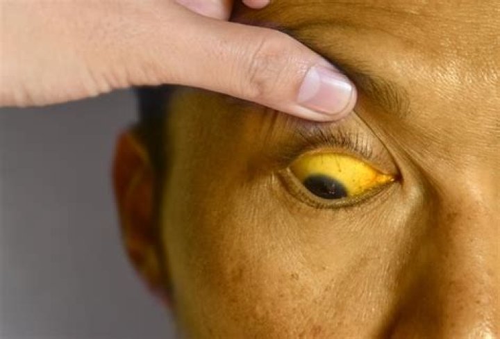 What is the meaning of yellowishness?