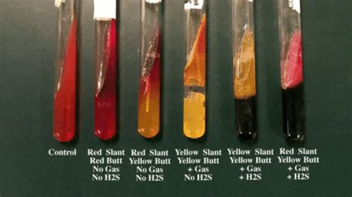 When is tsi testing?