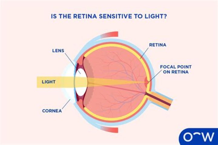 When light is focused in front of the retina?