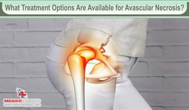 Where can you get avascular necrosis?