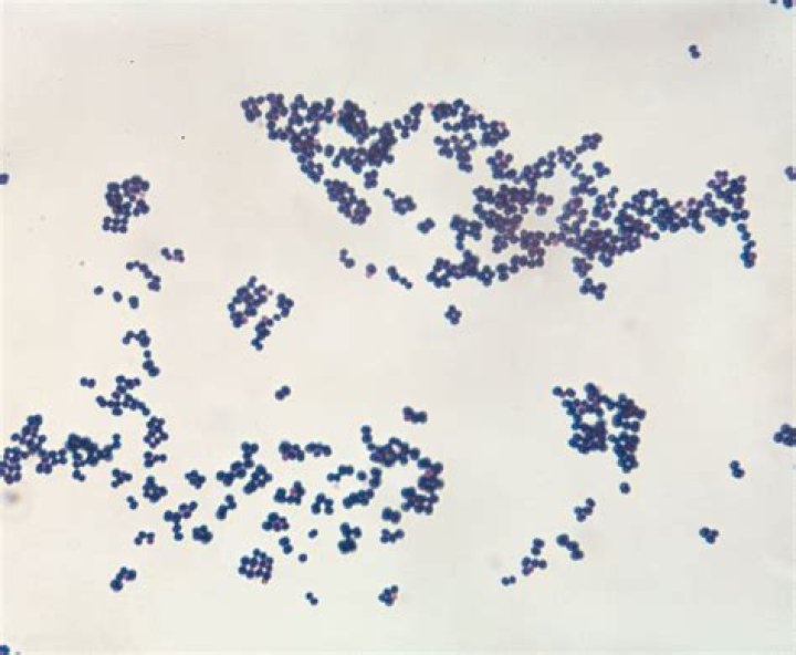 Who discovered micrococcus luteus?