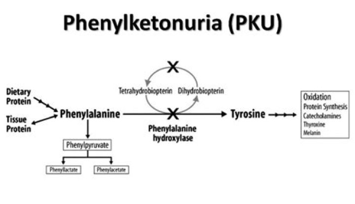 Why does pku cause microcephaly?