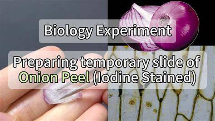 Why iodine used to stain the onion peel?