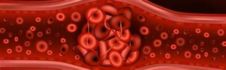 Why is eliquis taken twice a day?