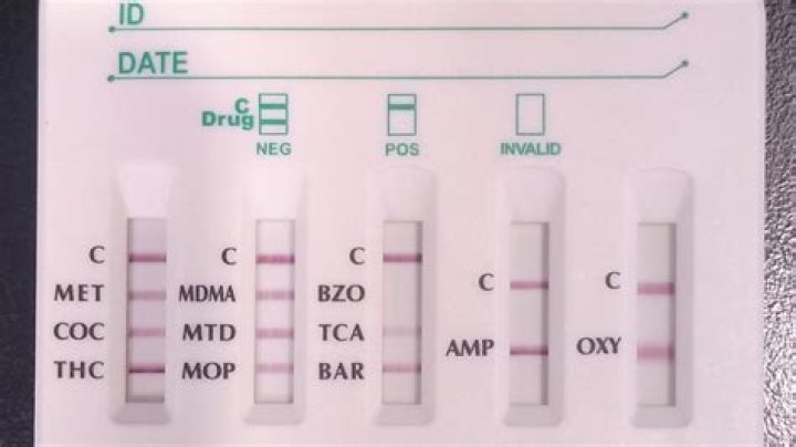 Will adipex test positive drug screen?