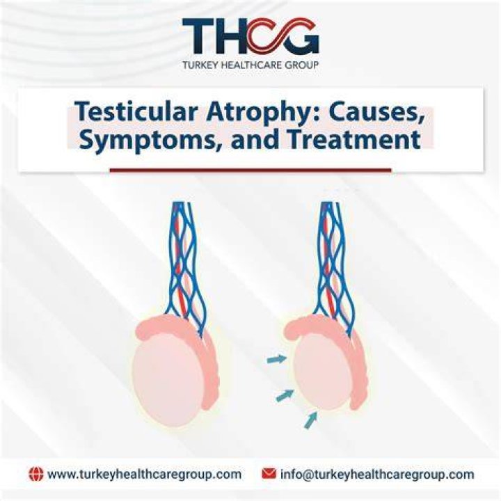 Will clomid help testicular atrophy?