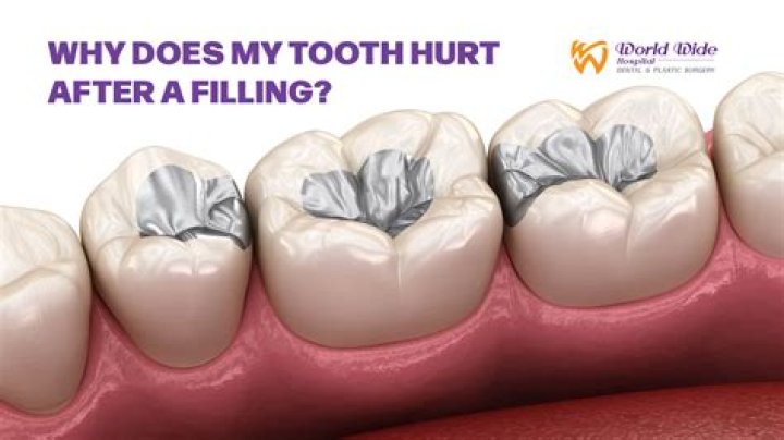 Will my tooth hurt after a filling?